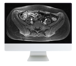 ARRS A Guide to Bowel Imaging 2019 (CME VIDEOS)