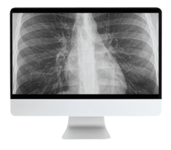 ARRS Liver, Pancreatic, and Biliary Tumors 2022