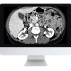 ARRS Gastrointestinal Imaging Online Course 2019 (CME VIDEOS)