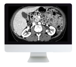 ARRS Gastrointestinal Imaging Online Course 2019 (CME VIDEOS)