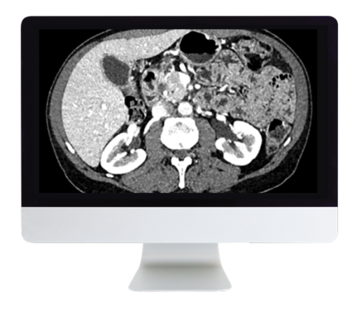 ARRS Gastrointestinal Imaging Online Course 2019 oc gi19 new 510x446 1