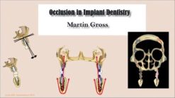 Occlusion in Implant Dentistry – Martin Gross (Course)