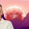 Early orthodontic treatment – when and how 2022