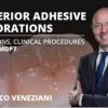 Osteocom Posterior Adhesive Restorations: Indications, Clinical Procedures and mDPT Techniques / Marco Veneziani