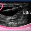 Pegasus Breast Ultrasound video course 2022