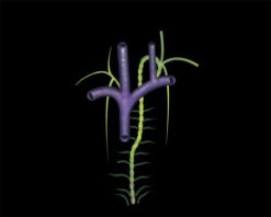 MRIOnline Mastery Series: Brachial Plexus 2022
