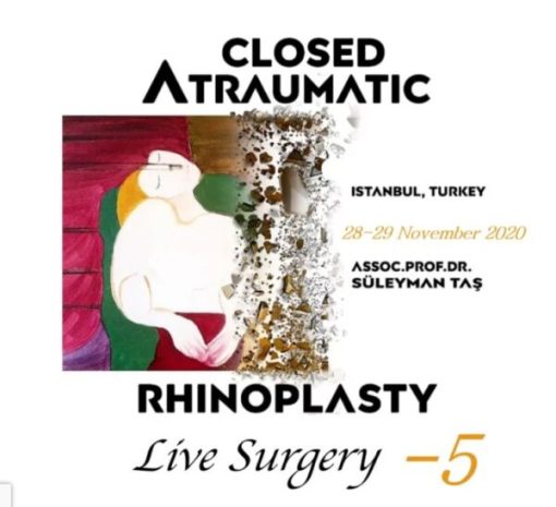 Closed Atraumatic Rhinoplasty Live Surgery DVD 5 screenshot 2023 03 16 101408 600x547 1 510x465 1