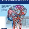 Video Atlas of Neuroendovascular Procedures 1st Edición