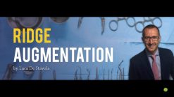 Ridge Augmentation – Luca De Stavola