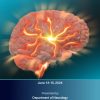Comprehensive Stroke Update 2024