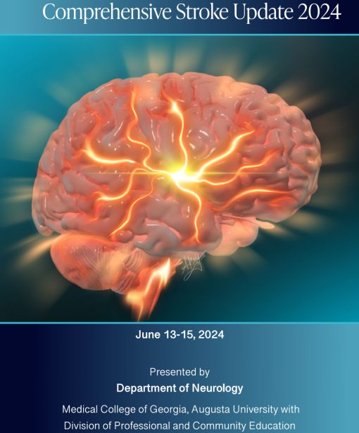 Comprehensive Stroke Update 2024