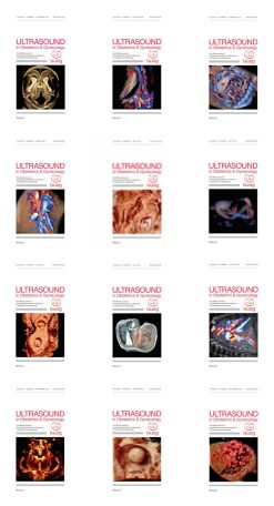 Ultrasound in Obstetrics & Gynecology 2024 Full Archives (True PDF)