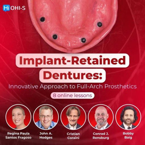 OHI-S Implant-Retained Dentures: Innovative Approach to Full-Arch Prosthetics