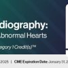 2025 Fetal Echocardiography: Normal and Abnormal Hearts – A Video CME Teaching Activity