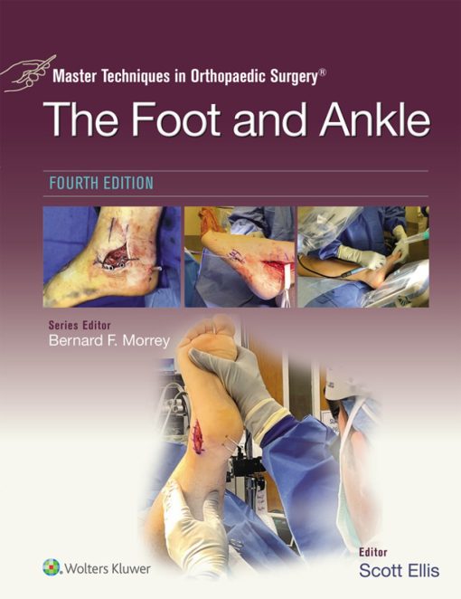 Master Techniques in Orthopaedic Surgery: The Foot and Ankle, 4th Edition (EPUB + Videos)