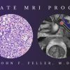 2021 Prostate MRI (Program 1) – John F. Feller, M.D