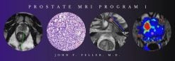 2021 Prostate MRI (Program 1) – John F. Feller, M.D