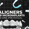 OHI-S Aligners And Microimplants In One Protocol