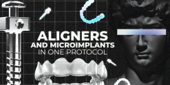 OHI-S Aligners And Microimplants In One Protocol