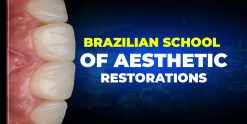 OHI-S Brazilian School of Aesthetic Restorations
