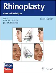 Rhinoplasty: Cases and Techniques 2e (Original PDF from Publisher+Videos)