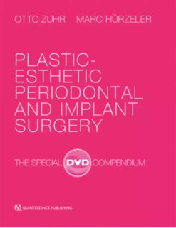 Plastic-Esthetic Periodontal and Implant Surgery The Special DVD Compendium