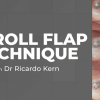 The S Roll Flap Technique
