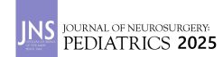 Journal of Neurosurgery: Pediatrics 2025 Archives (True PDF)