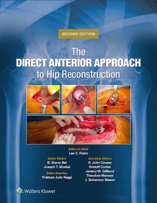 The Direct Anterior Approach to Hip Reconstruction, 2nd Edition (EPUB)