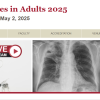 harvard Infectious Diseases in Adults 2025