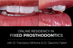 gIDE Institute Online Certificate Program in Fixed Prosthodontics – Esthetic and Functional Rehabilitation of Natural Teeth
