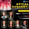 OHI-S – Apical Surgery: For Endodontists and Surgeons