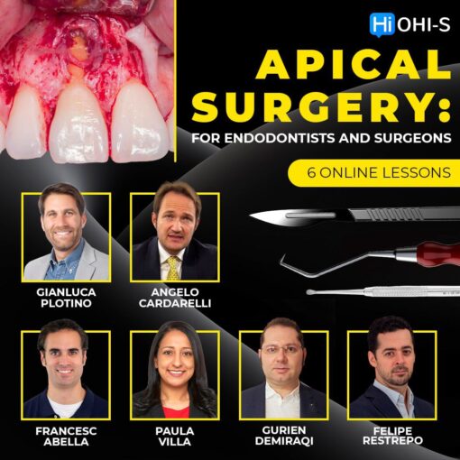 OHI-S – Apical Surgery: For Endodontists and Surgeons