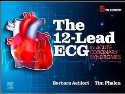 The 12-Lead ECG in Acute Coronary Syndromes, 5th Edition (Original PDF from Publisher)