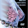Breast Reconstructive Surgery PICCIN spanish videos with titles