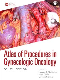 Atlas of Procedures in Gynecologic Oncology, 4th edition (Original PDF from Publisher)