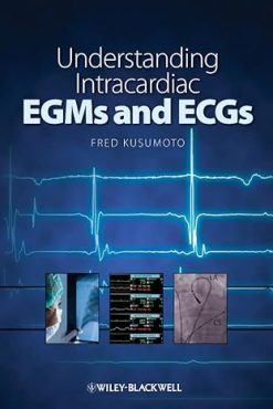 Understanding Intracardiac EGMs and ECGs 1st Edition