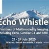 Echo Whistler Frontiers of Multimodality Imaging Including Echo, Cardiac CT and MRI (Videos + Slides)