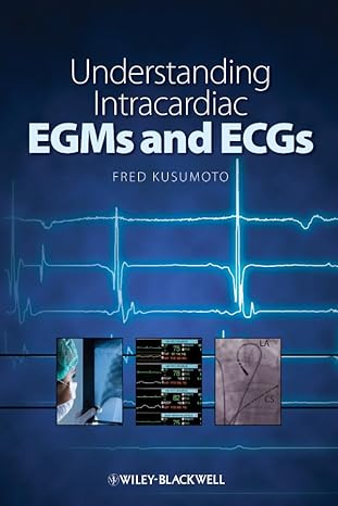 Understanding Intracardiac EGMs and ECGs 1st Edition