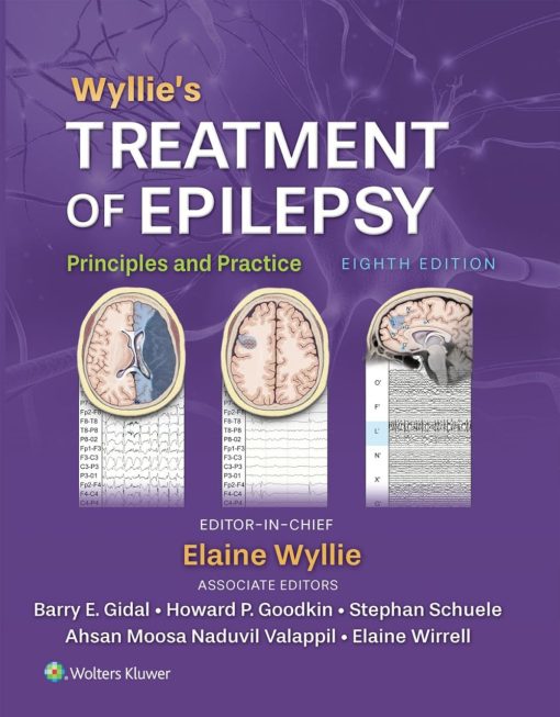 Wyllie’s Treatment of Epilepsy: Principles and Practice, 8th Edition EPUD and converted pdf