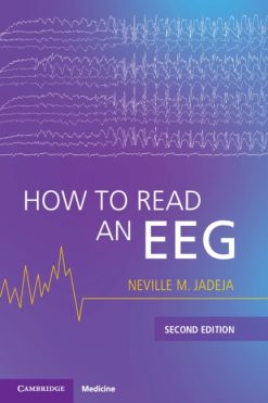 How to Read an EEG, 2nd Edition (Original PDF from Publisher)
