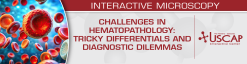 USCAP Challenges in Hematopathology Tricky Differentials and Diagnostic Dilemmas 2025