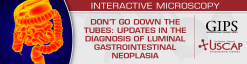 USCAP Don't Go Down the Tubes: Updates in the Diagnosis of Luminal Gastrointestinal Neoplasia 2025