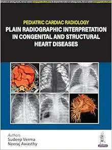 Pediatric Cardiac Radiology