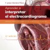 Aprender a interpretar el electrocardiograma