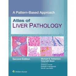 Atlas of Liver Pathology: A Pattern-Based Approach, 2nd Edition (EPUB)