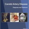 Carotid Artery Disease: Diagnosis and Treatment (True PDF from Publisher)