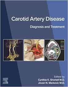 Carotid Artery Disease: Diagnosis and Treatment (True PDF from Publisher)