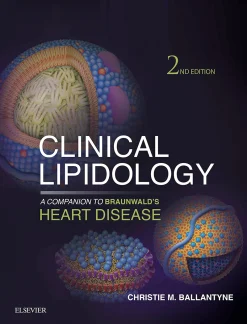 Clinical Lipidology: A Companion to Braunwald’s Heart Disease, 2nd Edition (EPUB)