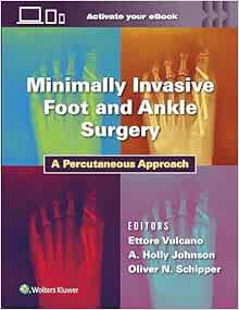 Minimally Invasive Foot and Ankle Surgery: A Percutaneous Approach (ePub+Converted PDF)